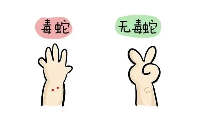 毒蛇的咬痕一般表现为1—4个出血点,多数情况为2个;无毒蛇为两排细小牙痕 图源:青岛卫生健康